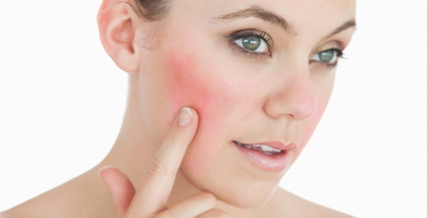 TRACTAMENTS PELLS SENSIBLES